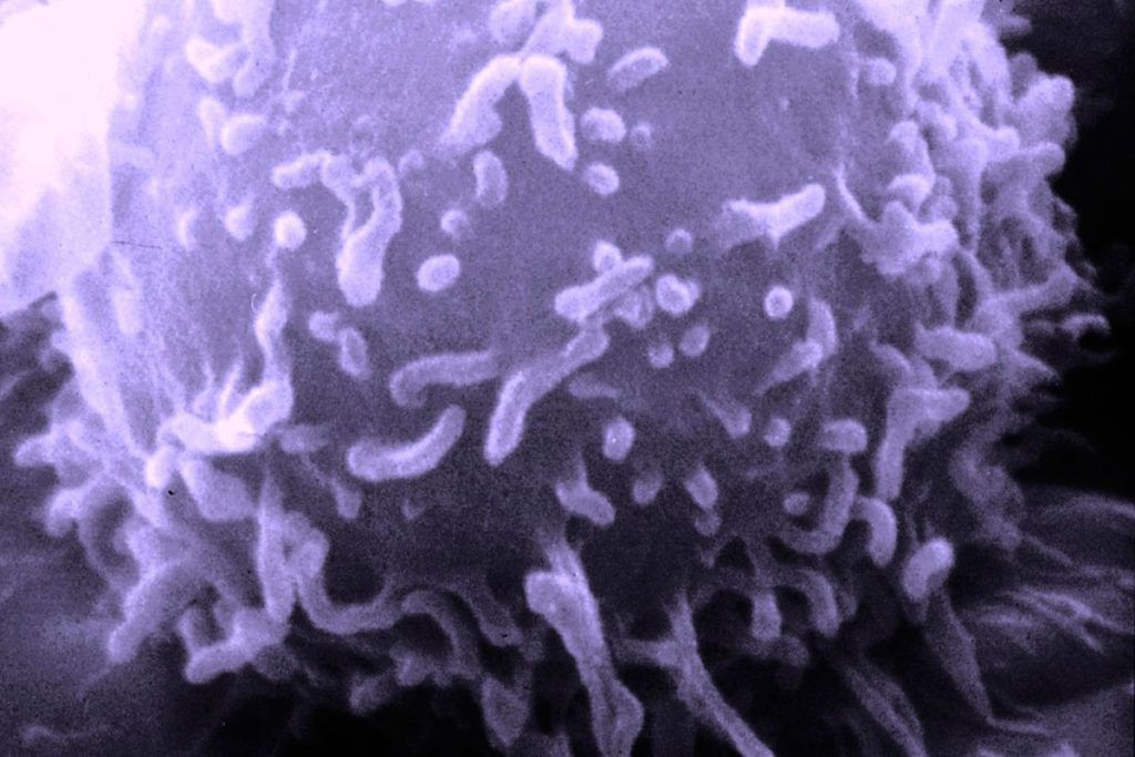 Descubren cómo el cáncer evita el sistema inmune