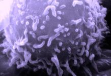 Descubren cómo el cáncer evita el sistema inmune Descubren cómo el cáncer evita el sistema inmune