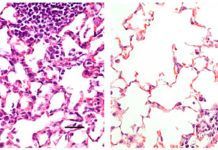 Hacia la vacuna nasal contra Covid-19 Hacia la vacuna nasal contra Covid-19