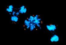 Descubren cómo atacar a las células cancerosas sin dañar a las sanas Descubren cómo atacar a las células cancerosas sin dañar a las sanas
