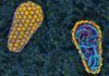Visión sin precedentes del VIH revela pasos para causar SIDA Desvelan los primeros pasos de la infección por VIH