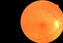 Examen ocular con IA para diagnóstico temprano de Parkinson Examen ocular con IA para diagnostico temprano de Parkinson