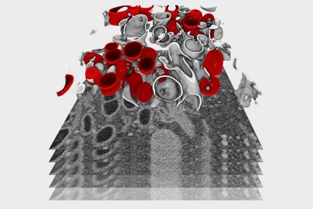 Desvelan en 3D el ciclo de replicación de SARS-CoV-2