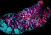 Analizan el genoma de las bacterias de la boca nalizan el genoma de las bacterias de la boca