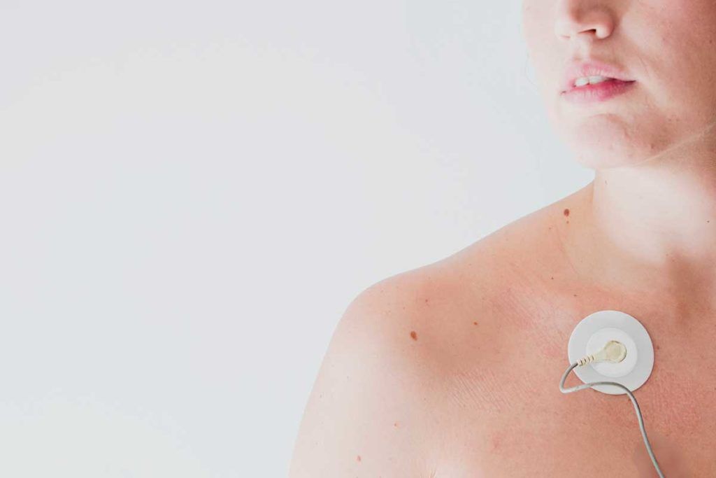 La fibrilación auricular afecta más a las mujeres de países ricos