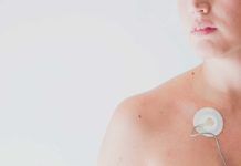 La fibrilación auricular afecta más a las mujeres de países ricos La fibrilación auricular afecta más a las mujeres de países ricos
