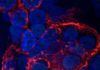 Cómo el coronavirus daña las células pulmonares en cuestión de horas Cómo el coronavirus daña las células pulmonares en cuestión de horas
