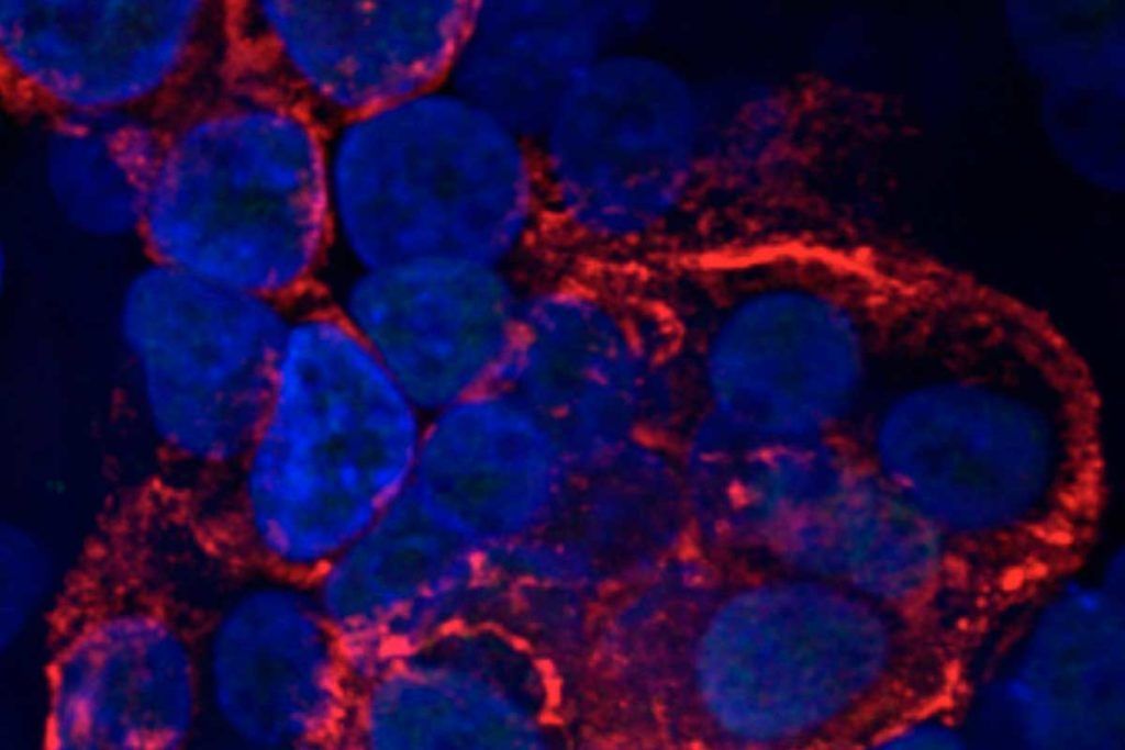 Cómo el coronavirus daña las células pulmonares en cuestión de horas