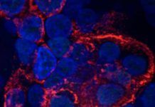 Cómo el coronavirus daña las células pulmonares en cuestión de horas Cómo el coronavirus daña las células pulmonares en cuestión de horas