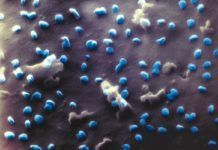 SARS-CoV-2 en 3D con microscopio de iones de helio SARS-CoV-2 en 3D con microscopio de iones de helio