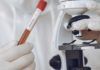 Más de 87.000 artículos científicos sobre el coronavirus en cinco meses Más de 87.000 artículos científicos sobre el coronavirus en pocos meses