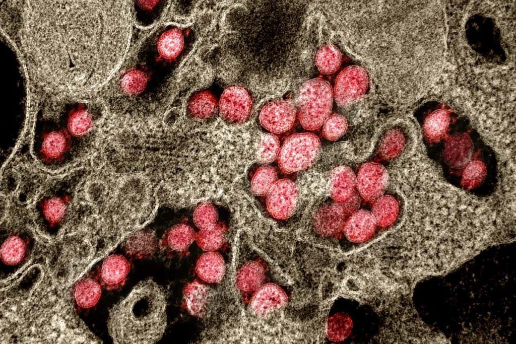 Fauci: Acabar con la pandemia depende de una respuesta global