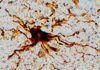 Genes ‘zombis’ sobreviven en el cerebro después de la muerte Genes zombis sobreviven en el cerebro después de la muerte