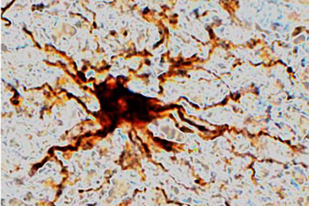 Genes zombis sobreviven en el cerebro después de la muerte