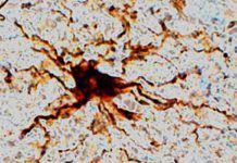 Genes ‘zombis’ sobreviven en el cerebro después de la muerte Genes zombis sobreviven en el cerebro después de la muerte