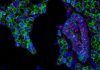 Hallan evidencias de que el coronavirus se transmite también por la saliva Hallan evidencias de que el coronavirus se transmite también por la saliva