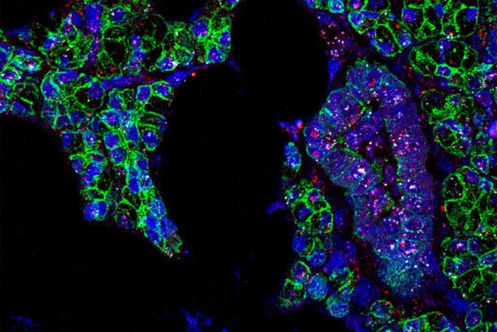 Hallan evidencias de que el coronavirus se transmite también por la saliva