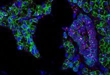 Hallan evidencias de que el coronavirus se transmite también por la saliva Hallan evidencias de que el coronavirus se transmite también por la saliva