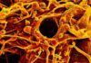Desvelan el complicado proceso infeccioso del SARS-CoV-2 Desvelan el complicado proceso infeccioso del SARS-CoV-2