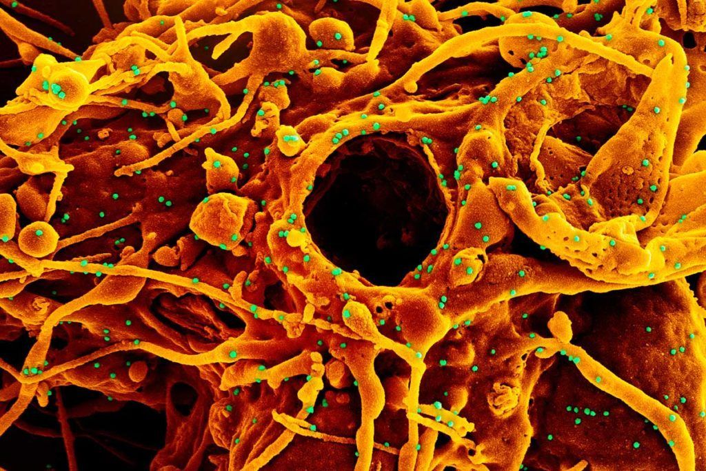 Desvelan el complicado proceso infeccioso del SARS-CoV-2