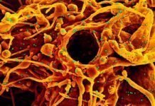 Desvelan el complicado proceso infeccioso del SARS-CoV-2 Desvelan el complicado proceso infeccioso del SARS-CoV-2