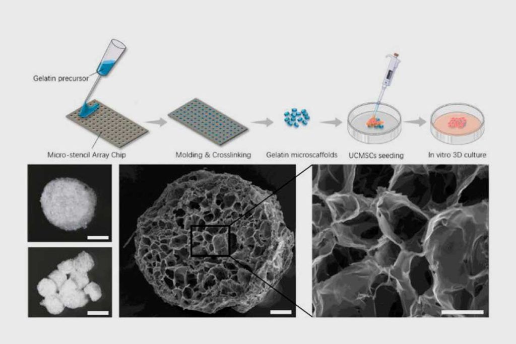 Revierten la osteoartritis en laboratorio con un ingenio de biomaterial en 3D