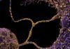 Desvelan cómo los coronavirus SARS generan nuevas copias Desvelan cómo los coronavirus SARS generan nuevas copias