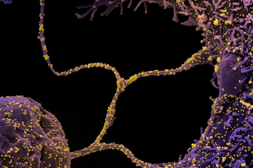 Desvelan cómo los coronavirus SARS generan nuevas copias