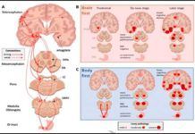 Resuelven el misterio de la asimetría motora en el mal de Parkinson Resuelven el misterio de la asimetría motora en el mal de Parkinson