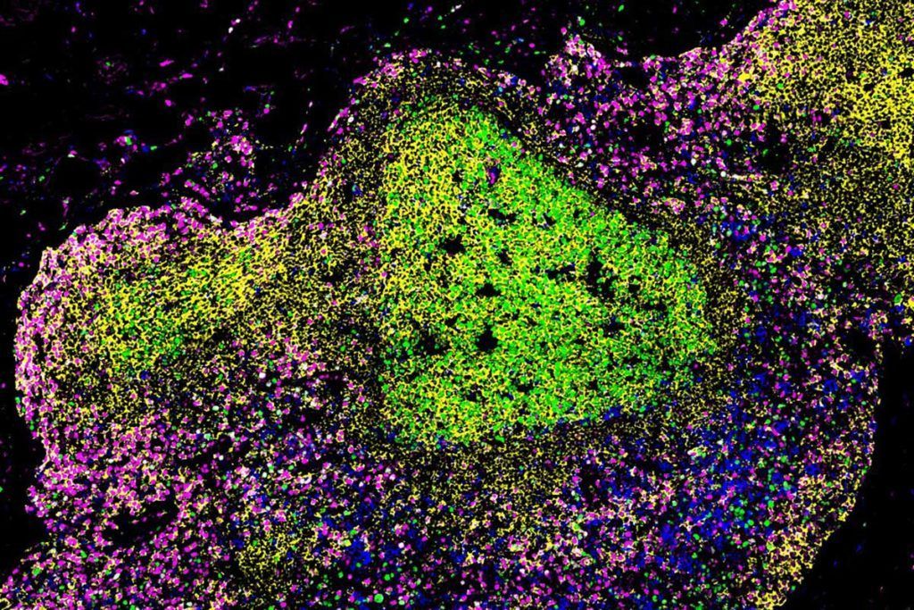 Desnudan al virus del sida para que el sistema inmune acabe con él