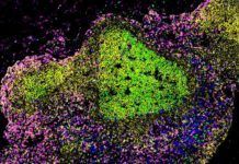 Desnudan al virus del sida para que el sistema inmune acabe con él Desnudan al virus del sida para que el sistema inmune acabe con él