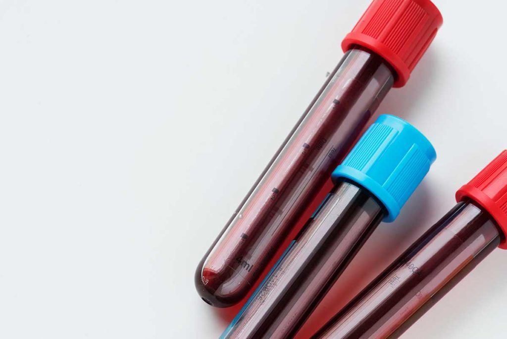 Validan una prueba que detecta con precisión 50 tipos de cáncer