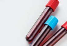 Validan una prueba que detecta con precisión 50 tipos de cáncer Validan una prueba que detecta con precisión 50 tipos de cáncer