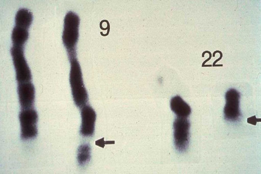 Dra. Bendala: La historia oculta y veraz del cromosoma Filadelfia