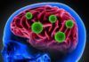 Covid-19 daña el cerebro de algunos enfermos como lo hace el mal de Alzheimer Covid-19 daña el cerebro de algunos infectados como hace el mal de Alzheimer