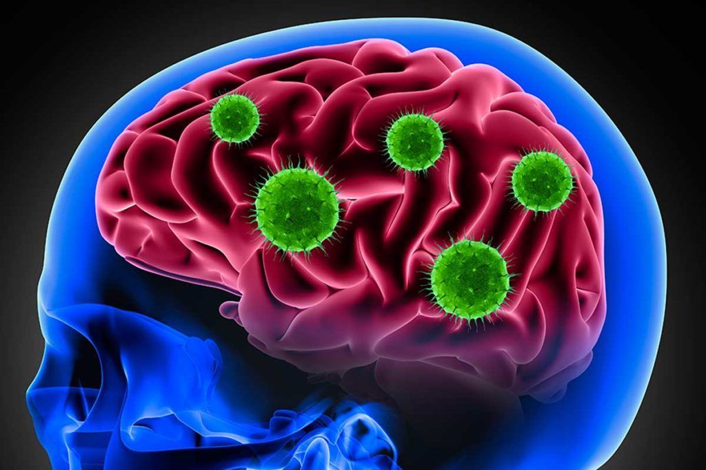 Covid-19 daña el cerebro de algunos infectados como hace el mal de Alzheimer