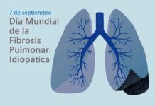 Dr. Ancoechea: El reto de alternativas terapéuticas más selectivas para la fibrosis pulmonar Dr. Ancoechea: El reto de alternativas terapéuticas más selectivas para la fibrosis pulmonar