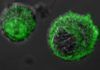 Desvelan cómo las células cancerosas producen ácido láctico para sobrevivir Desvelan cómo las células cancerosas producen ácido láctico para sobrevivir