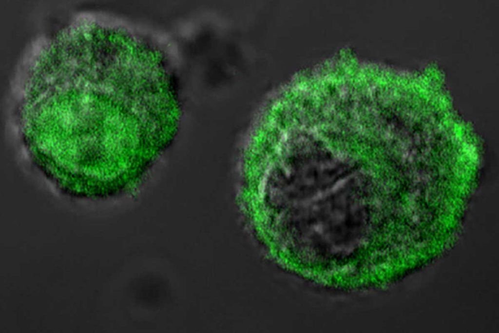 Desvelan cómo las células cancerosas producen ácido láctico para sobrevivir