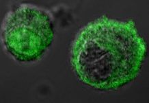 Desvelan cómo las células cancerosas producen ácido láctico para sobrevivir Desvelan cómo las células cancerosas producen ácido láctico para sobrevivir