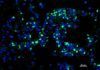 Una clase de glóbulos blancos ayuda a combatir el cáncer Una clase de glóbulos blancos ayuda a combatir el cáncer