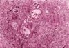 Desnudan al virus del Valle del Rift, que tiene potencial pandémico Desnudan al virus del Valle del Rift, que tiene potencial pandémico