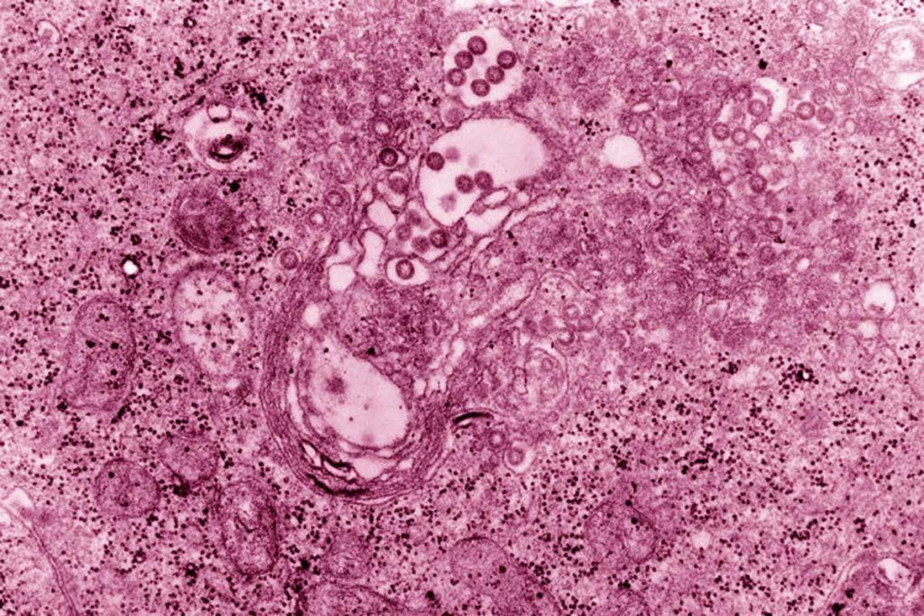 Desnudan al virus del Valle del Rift, que tiene potencial pandémico