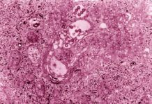 Desnudan al virus del Valle del Rift, que tiene potencial pandémico Desnudan al virus del Valle del Rift, que tiene potencial pandémico