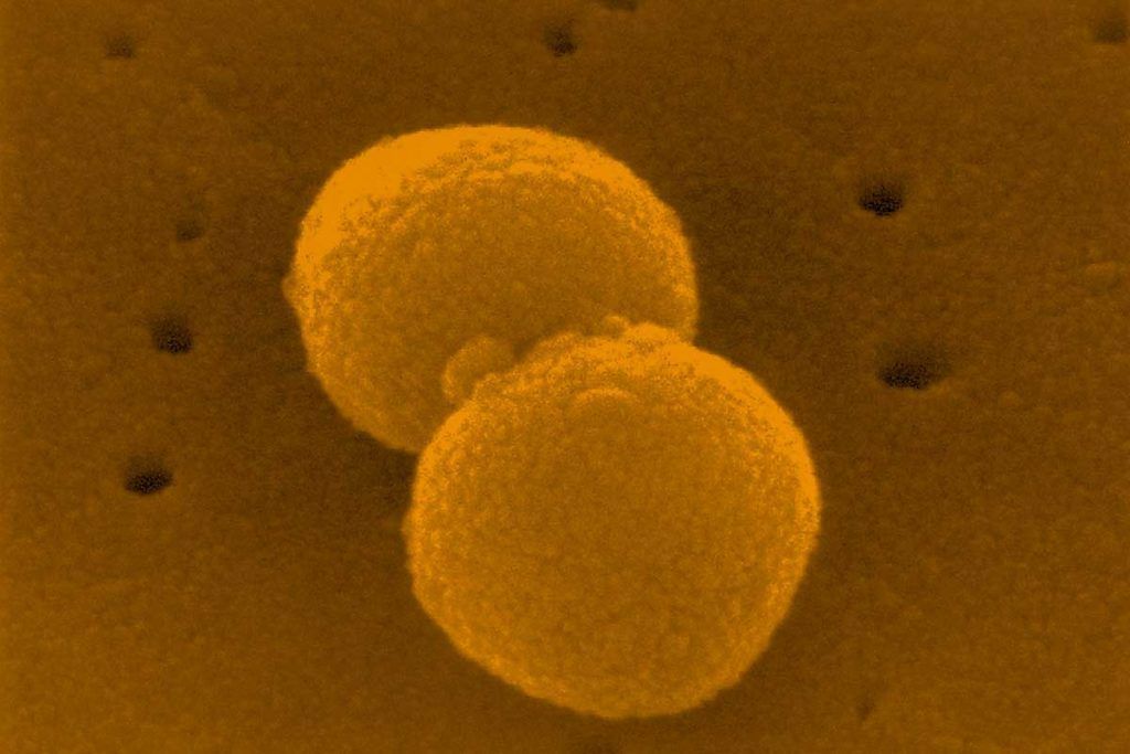 Nueva estrategia frente a la meningitis bacteriana, sin antibióticos