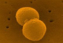 Nueva estrategia frente a la meningitis bacteriana, sin antibióticos Nueva estrategia frente a la meningitis bacteriana, sin antibióticos