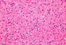 El virus B de la hepatitis estaba presente en Europa hace 10.000 años El virus B de la hepatitis estaba presente en Europa hace 10.000 años