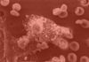 Innovador tratamiento para estimular el sistema inmune frente al cáncer Innovador tratamiento para estimular el sistema inmune frente al cáncer