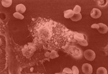 Innovador tratamiento para estimular el sistema inmune frente al cáncer Innovador tratamiento para estimular el sistema inmune frente al cáncer