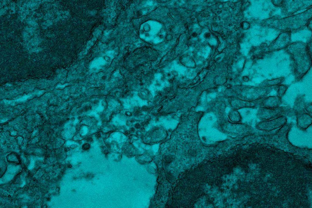 La nueva vacuna de nanopartículas tendrá mayor protección frente a las variantes del SARS-CoV-2